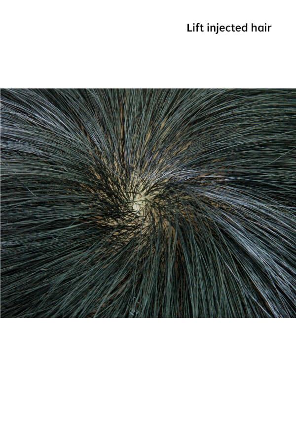 super-thin-skin-lift-inject-toupee
