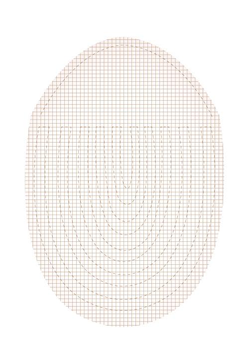 S2 hair replacement system