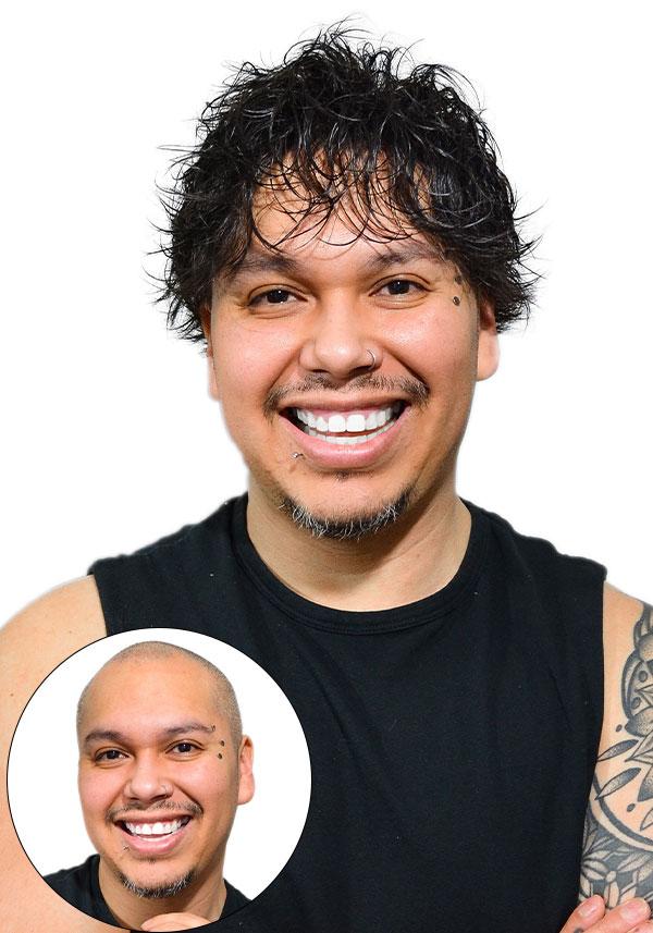 SuperSkin-V before vs after