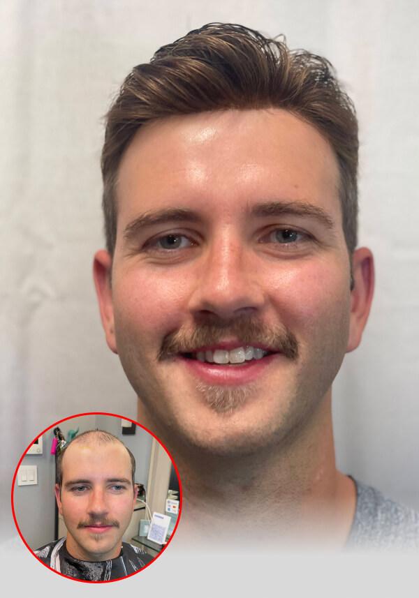 skin hair system