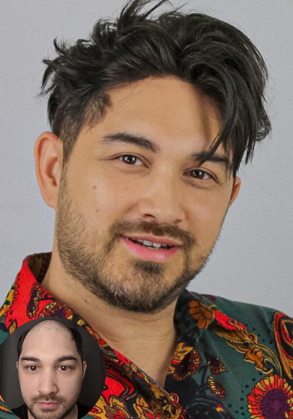 Men’s Clip-On Hair System