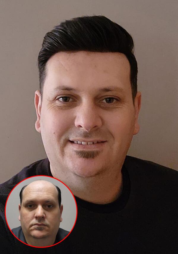 Super Thin Skin Hair Piece