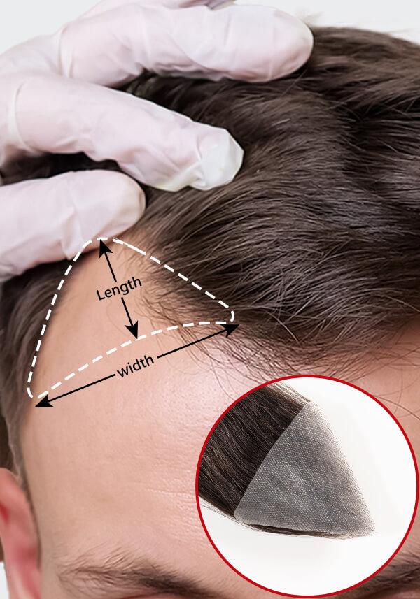 Temple Patch | Temple Hair Patch for Men