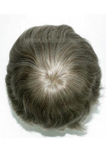 yj027 hair replacement system