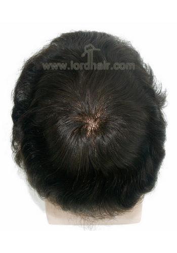 yj039 hair replacement system