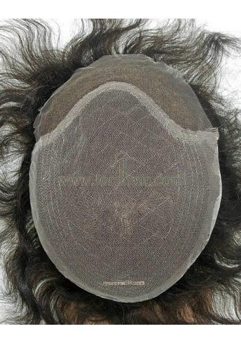 yj039 hair replacement system