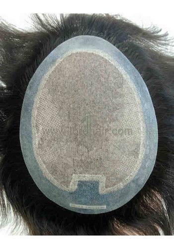 yj072 hair replacement system