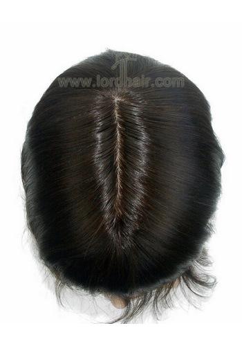 yj072 hair replacement system