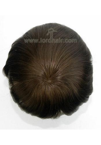 yj087 hair replacement system