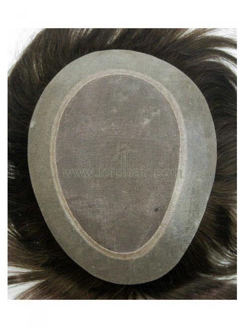 yj087 hair replacement system