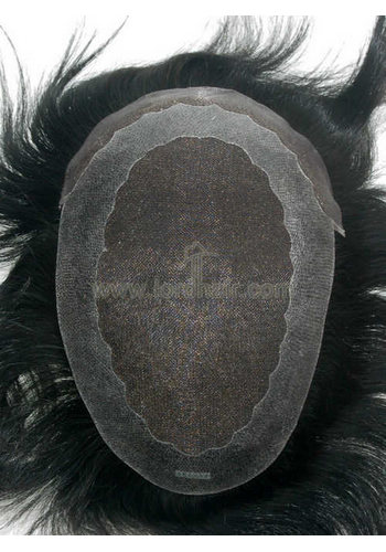 yj099a hair replacement system