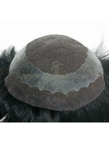 yj099a hair replacement system