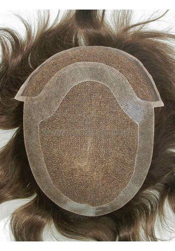 yj201 hair replacement system