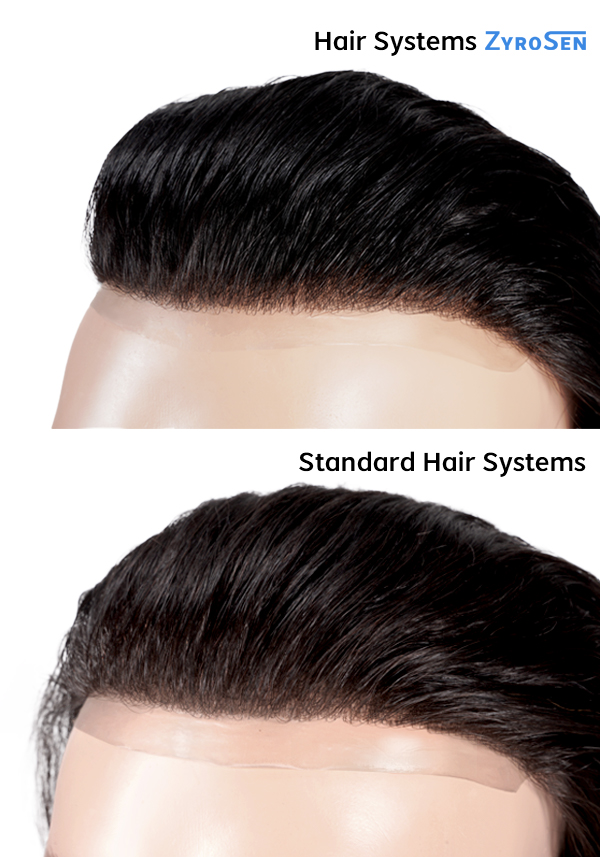 zyrosen hair system