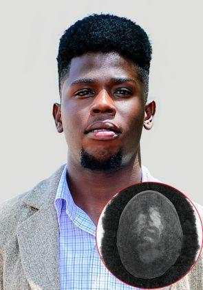 Endura Afro | African American Men’s Hair System with Thin Skin with Gauze base Injected
