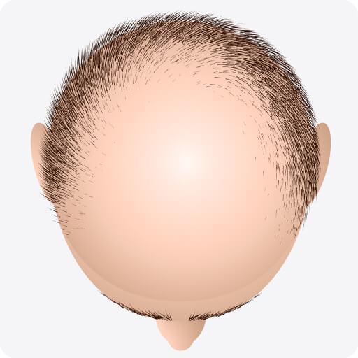 custom hair system
