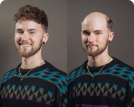Neo | Men's Hair Replacement Units with Natural Lace Front and Skin Perimeter