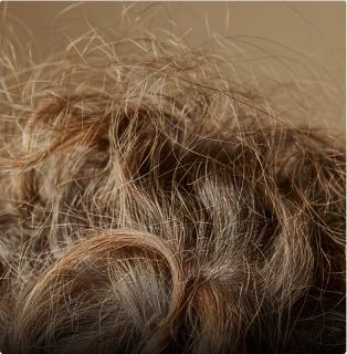 Hair system problem: Drying