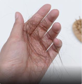 Hair system problem: Shedding