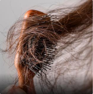 Hair system problem: Tangling