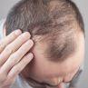 Ingrown Hair on the Scalp: Causes, Symptoms, Treatments, and More 