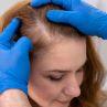 Dry, Flaky Scalps and Hair Loss: Is There a Connection?