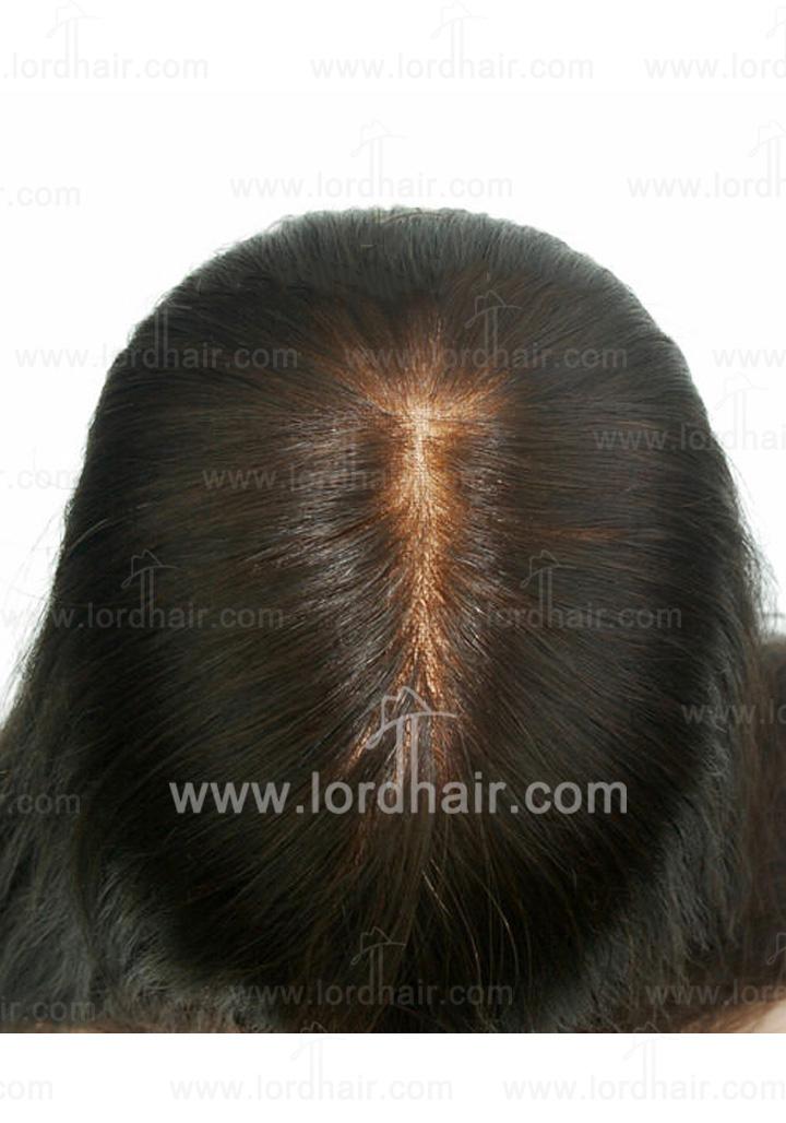 a001 hair replacement system