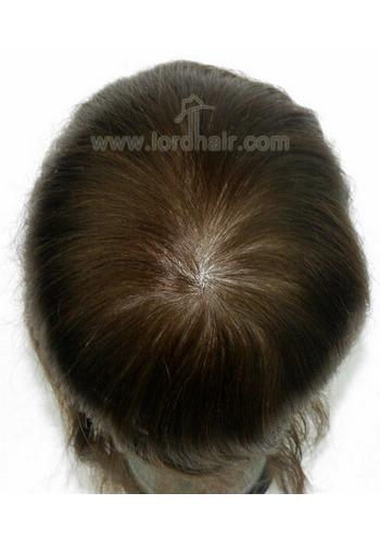 jq1167 hair replacement system
