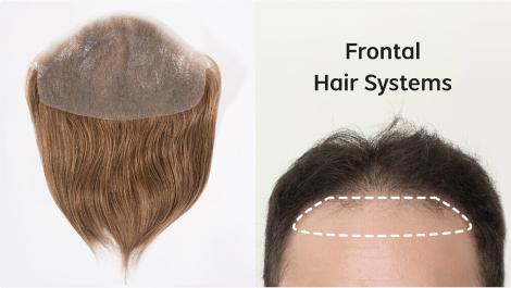 Frontal hair system