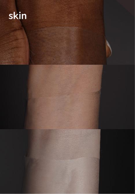 Skin hair system base