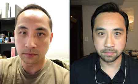 Men's Toupee Photo