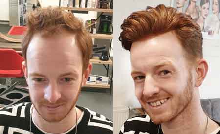 Men's Toupee Photo