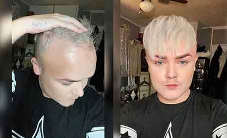 Men's Toupee Photo