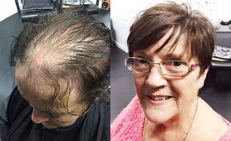 Men's Toupee Photo