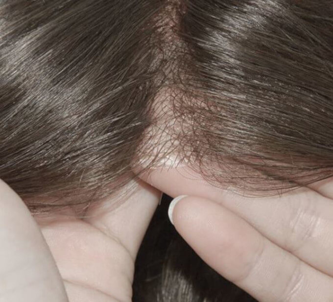 hair density on hair systems for man