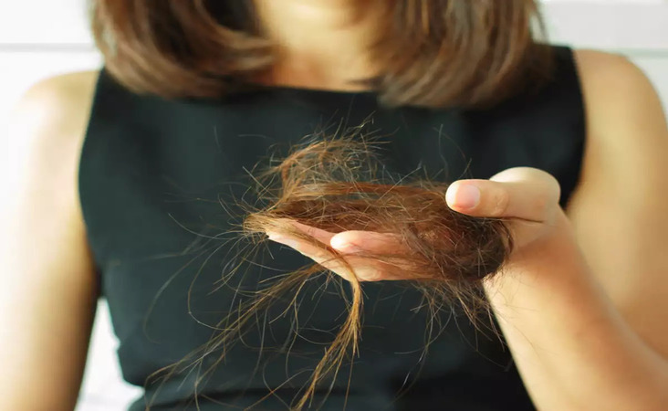 hair loss after weight loss