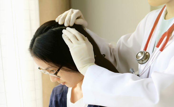 what doctor to see for hair loss