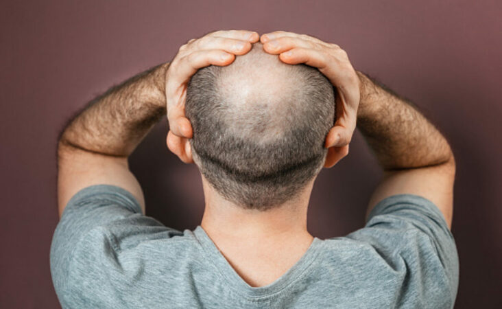 Haircuts for Balding Men  Cool Styles That Work