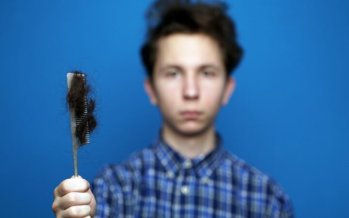 hair loss in teenage