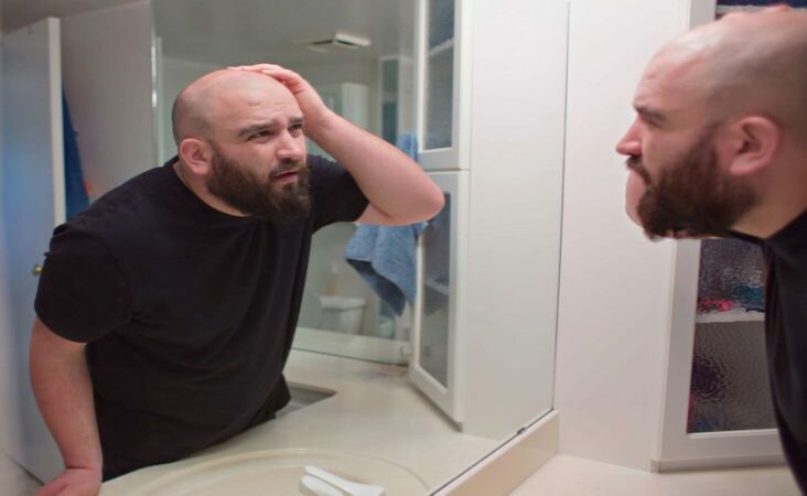 metformin and hair loss