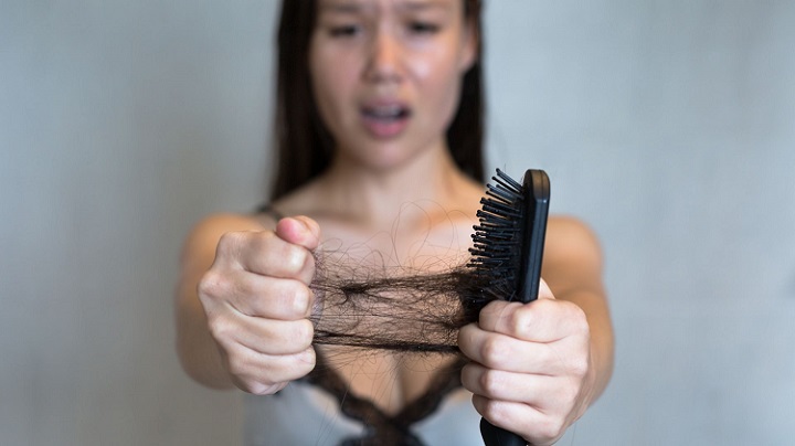 Causes of hair loss in teenage females