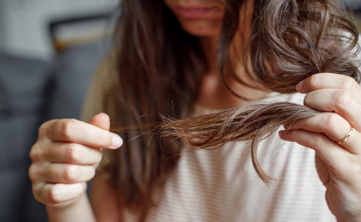 cowlick vs balding