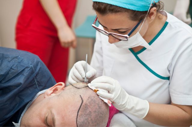 man undergoing hair transplant