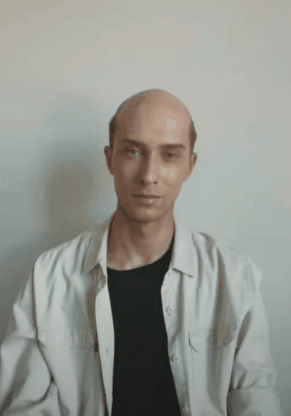 hair system before and after