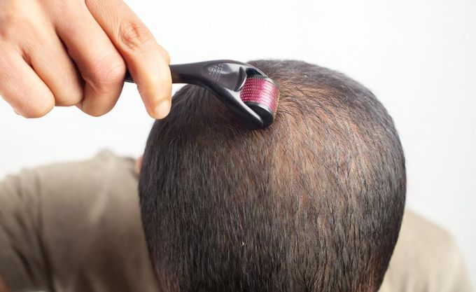 Microneedline for hair growth