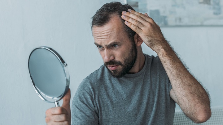 covid 19 hair loss