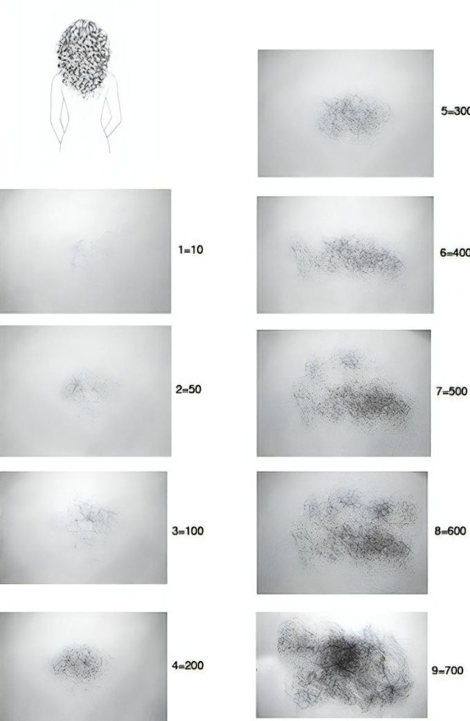 hair shedding visual scale