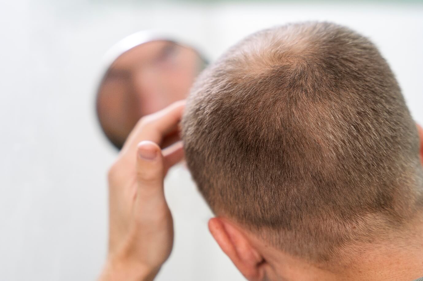 hair loss solutions