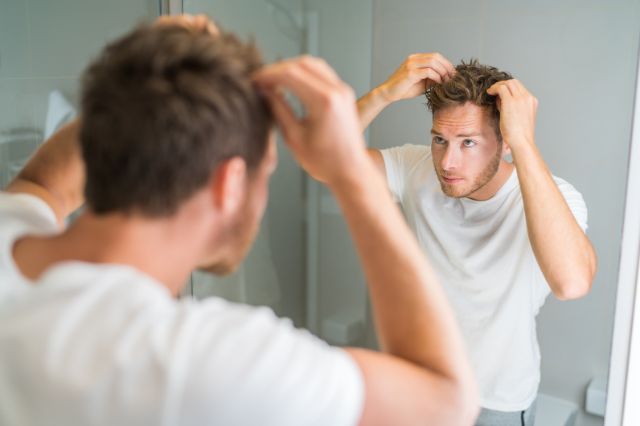 hair loss in teens