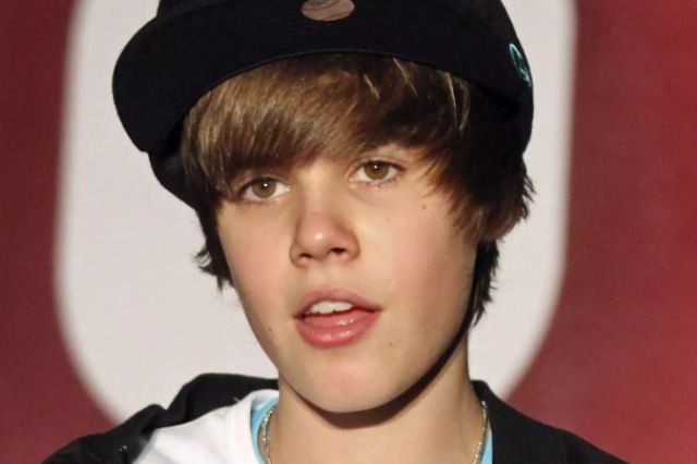 did justin bieber get a hair transplant 